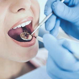 Close-up of female dental patient having her teeth examined