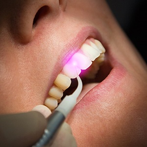 laser gum treatment