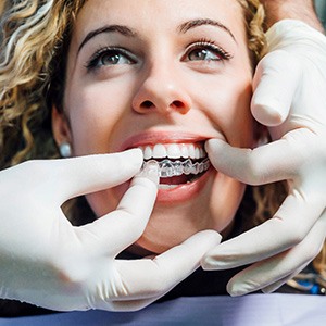 A dentist helping a woman put her Invisalign aligner on