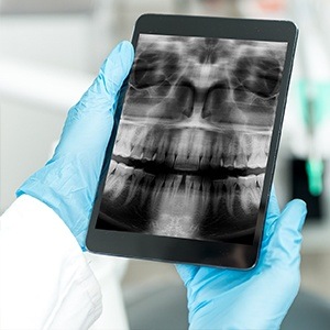 tablet with x-ray on it