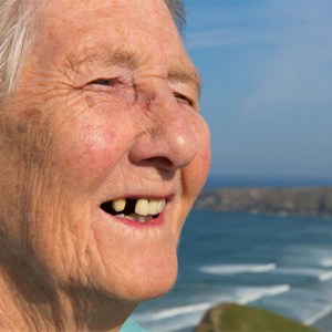 A closeup of an old woman with missing teeth		