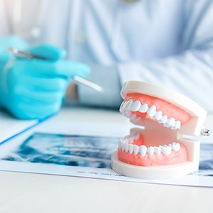 dentist explaining cost of dentures Costa Mesa