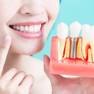 a patient in Costa Mesa smiling and holding a model of dental implants