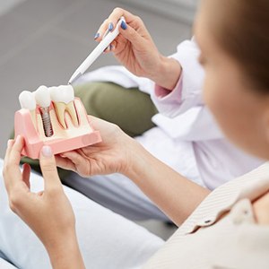 dentist showing a patient a model of a dental implant in the jaw