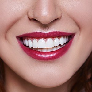 smile with propel treatment