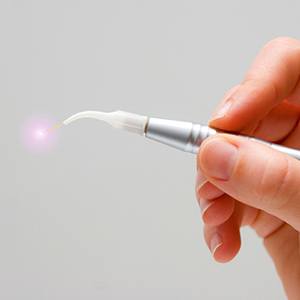 soft tissue laser