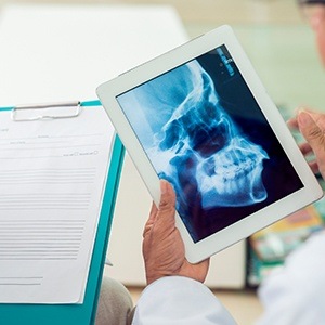 TMJ x-ray on tablet