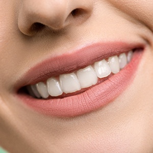 Woman with porcelain veneers smiling