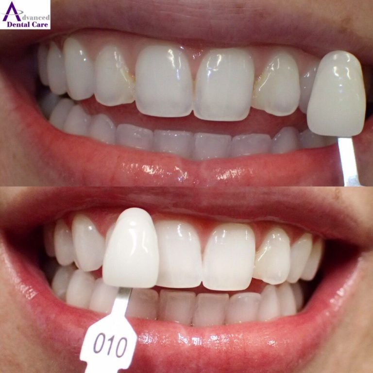 Dr. Jeremy Costa Mesa Dentist Emergency Dentist