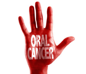 oral cancer written on hand