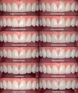 Porcelain Veneers - Costa Mesa - Cosmetic Dentist - Advanced Dental Care - Dr. William Dickerson 12-style LVI Smile Library