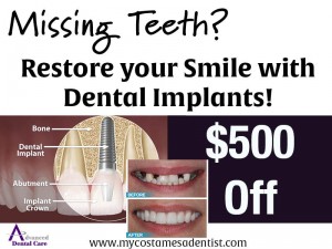 Your dentist for dental implants in Costa Mesa.