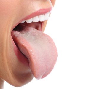 Woman who treated tongue-tie in Costa Mesa.